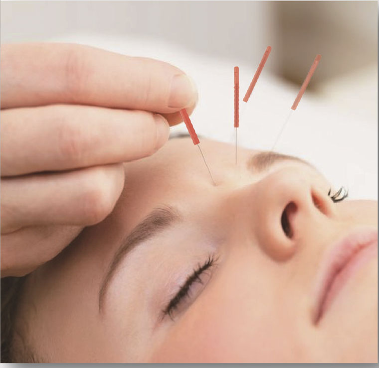 Cosmetic Acupuncture Clinic: About Cosmetic Acupuncture