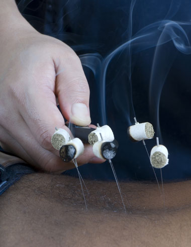 Acupuncture Clinic: What Acupuncturists Do